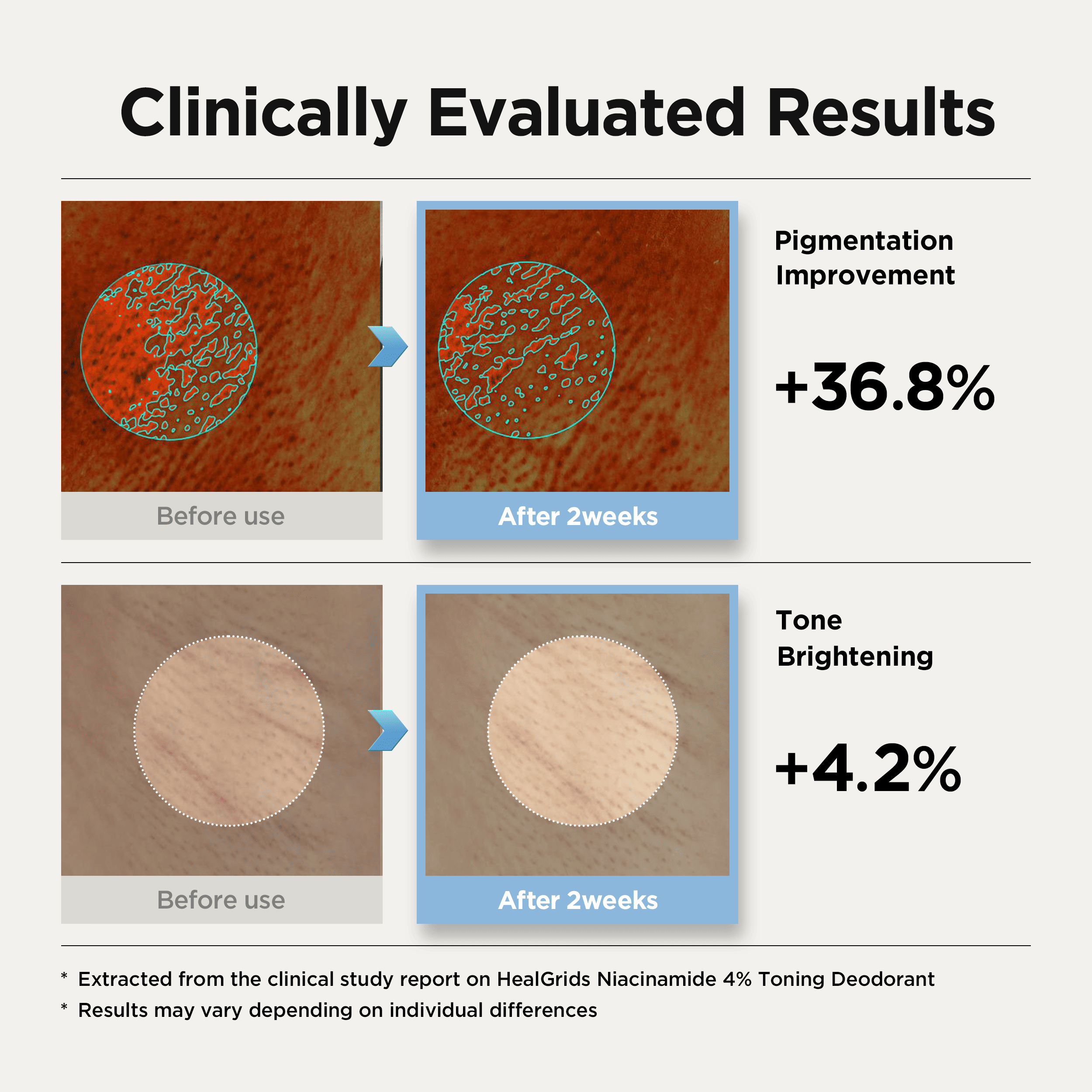 Niacinamide 4% toning deodorant - Imagen 3